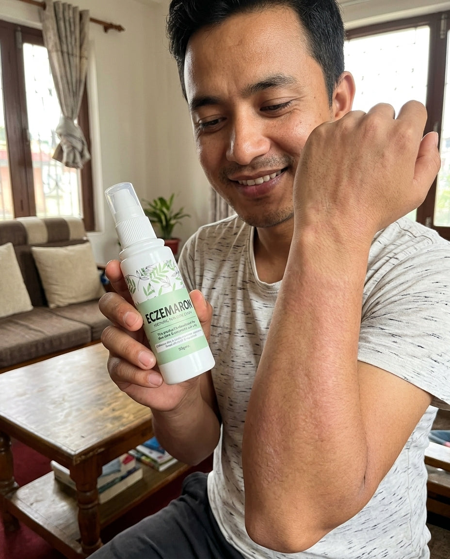 Eczemar ON – Ayurvedic Psoriasis & Eczema Moisturizing Cream