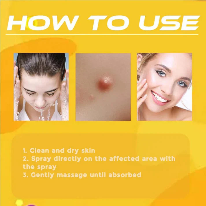Bee Venom Skin Tag & Wart Remover Spray - Rs.1199/-