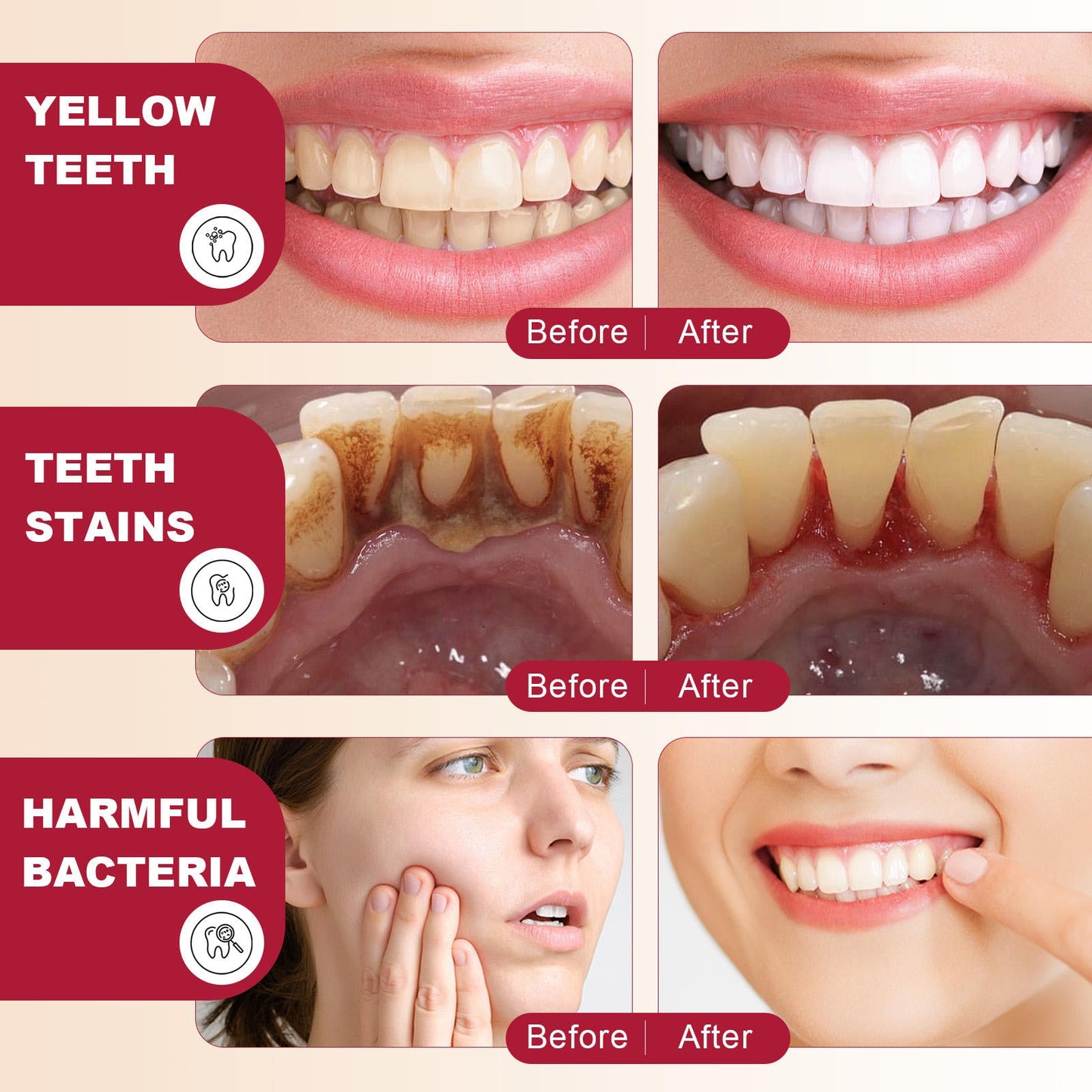 SP 4 Teeth Whitening Toothpaste